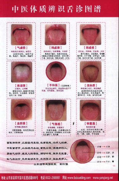 舌苔图
